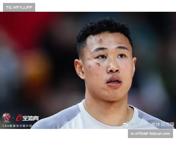 深圳队贺希宁带伤作战成常态 球员耐用性引发讨论